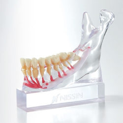 Mandibular Nervemodel